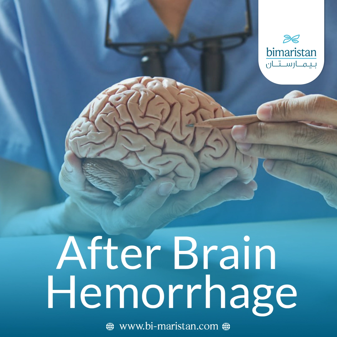 After A Cerebral Hemorrhage: Major Complications And Recovery