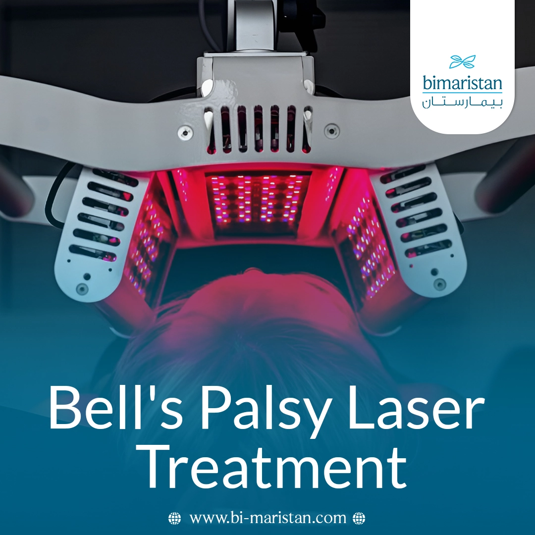 Bell'S Palsy Laser Treatment