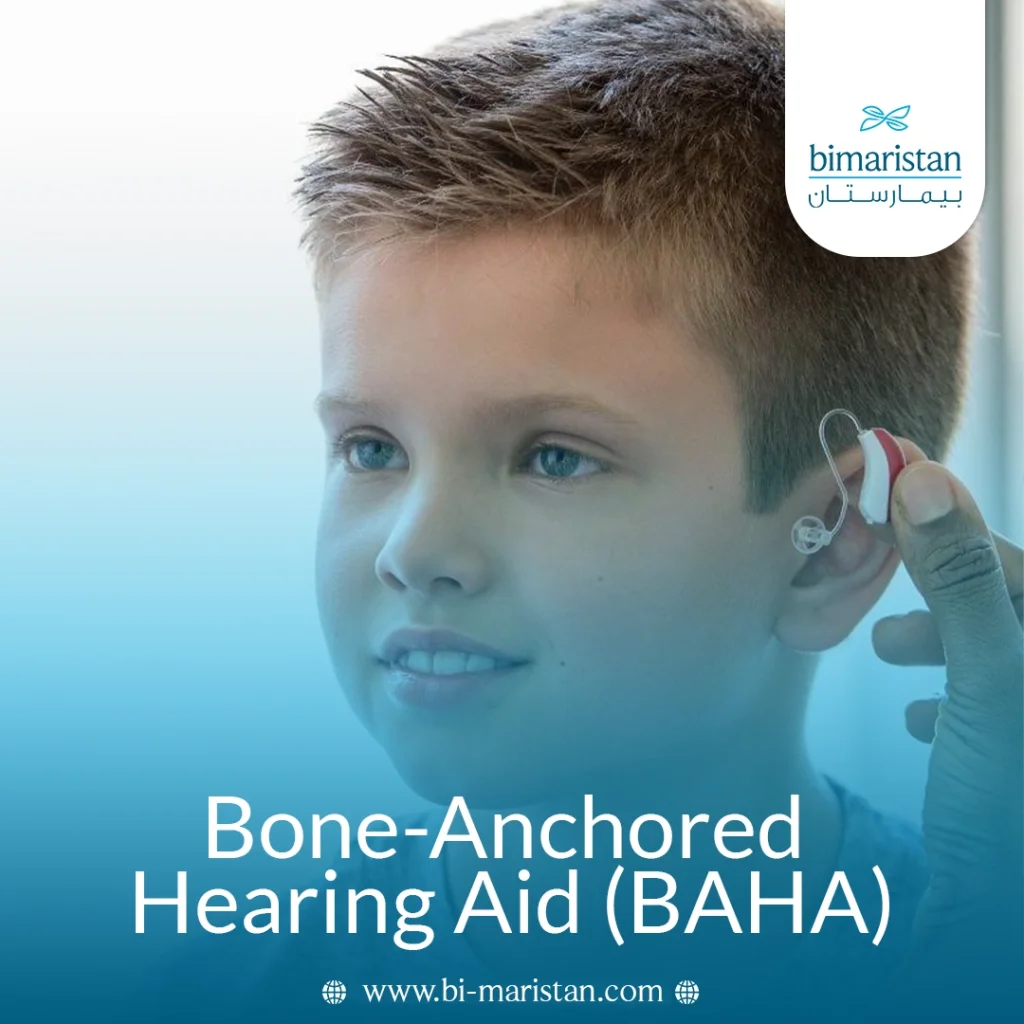 Bone Conduction Implants