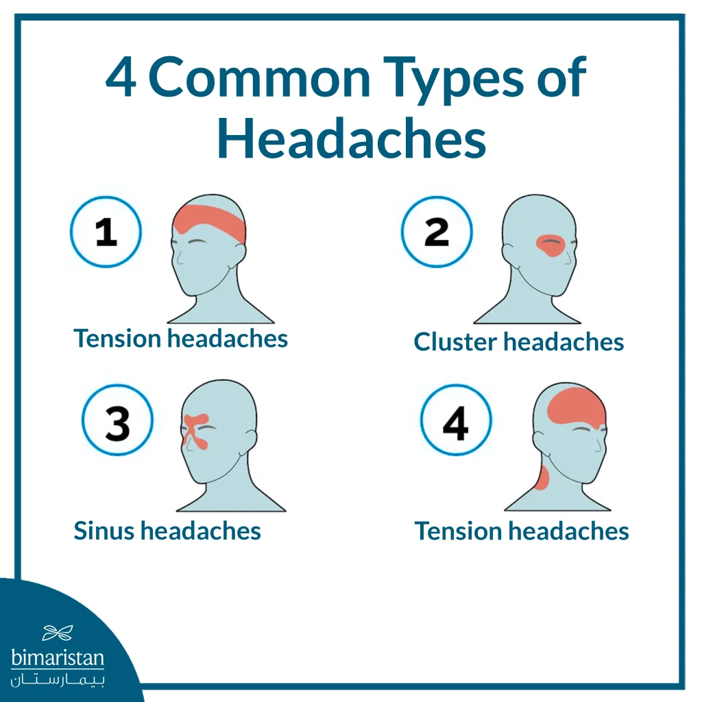 Common Types Of Headaches