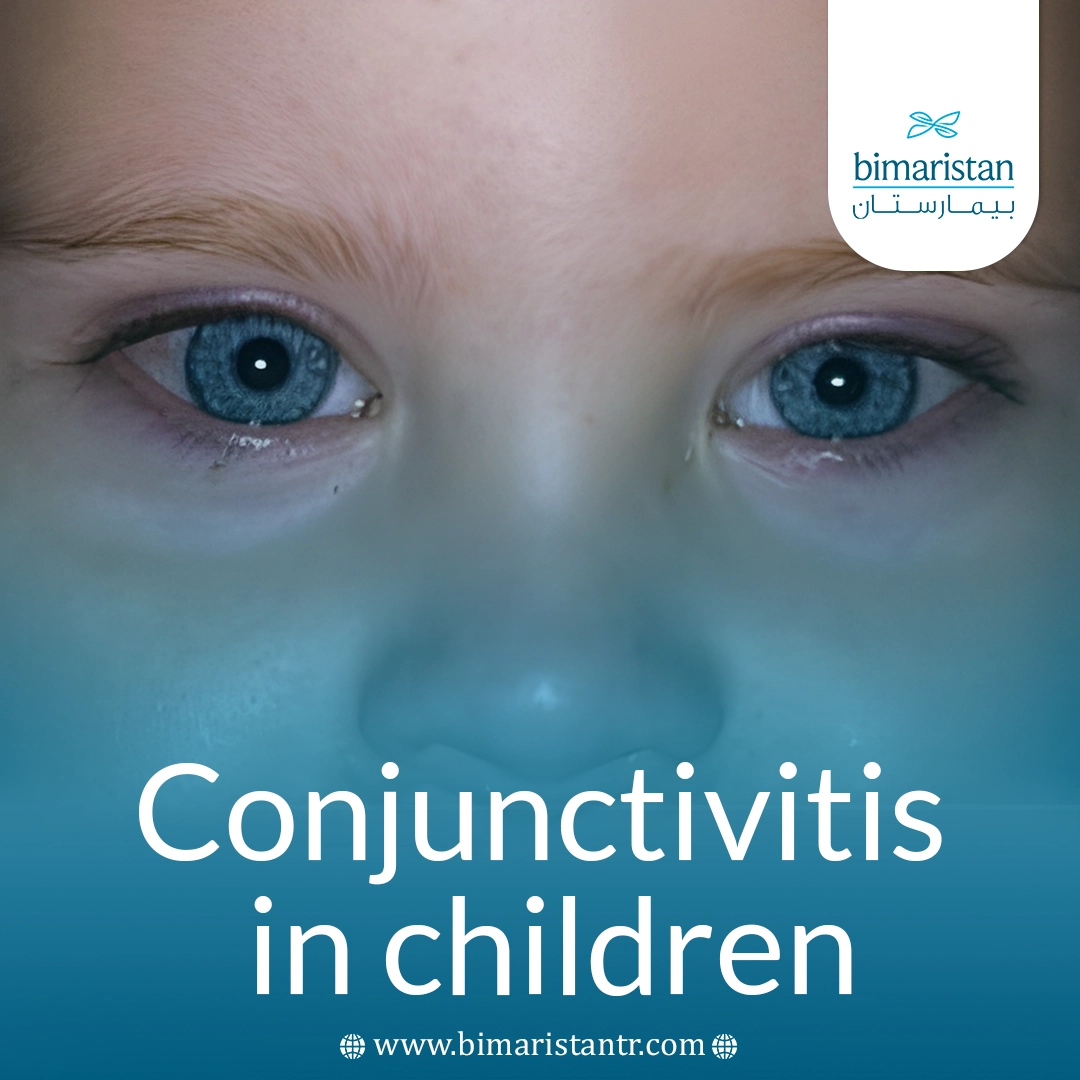 Conjunctivitis In Children