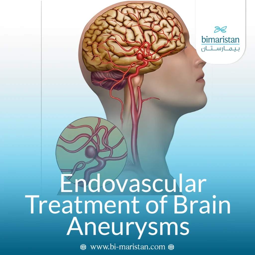Interventional Cerebral Artery Aneurysm Treatment