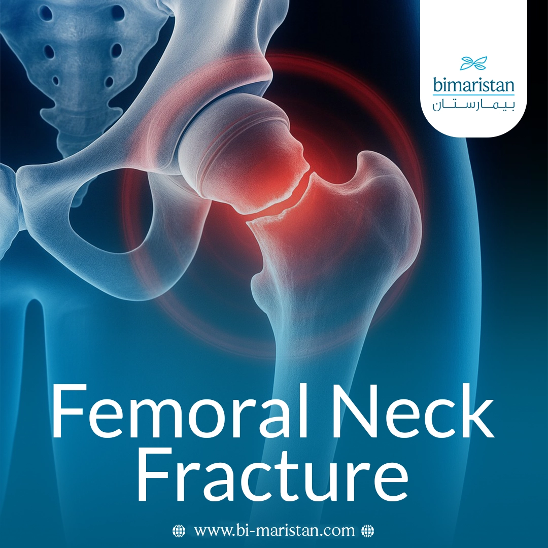 Femoral Neck Fracture