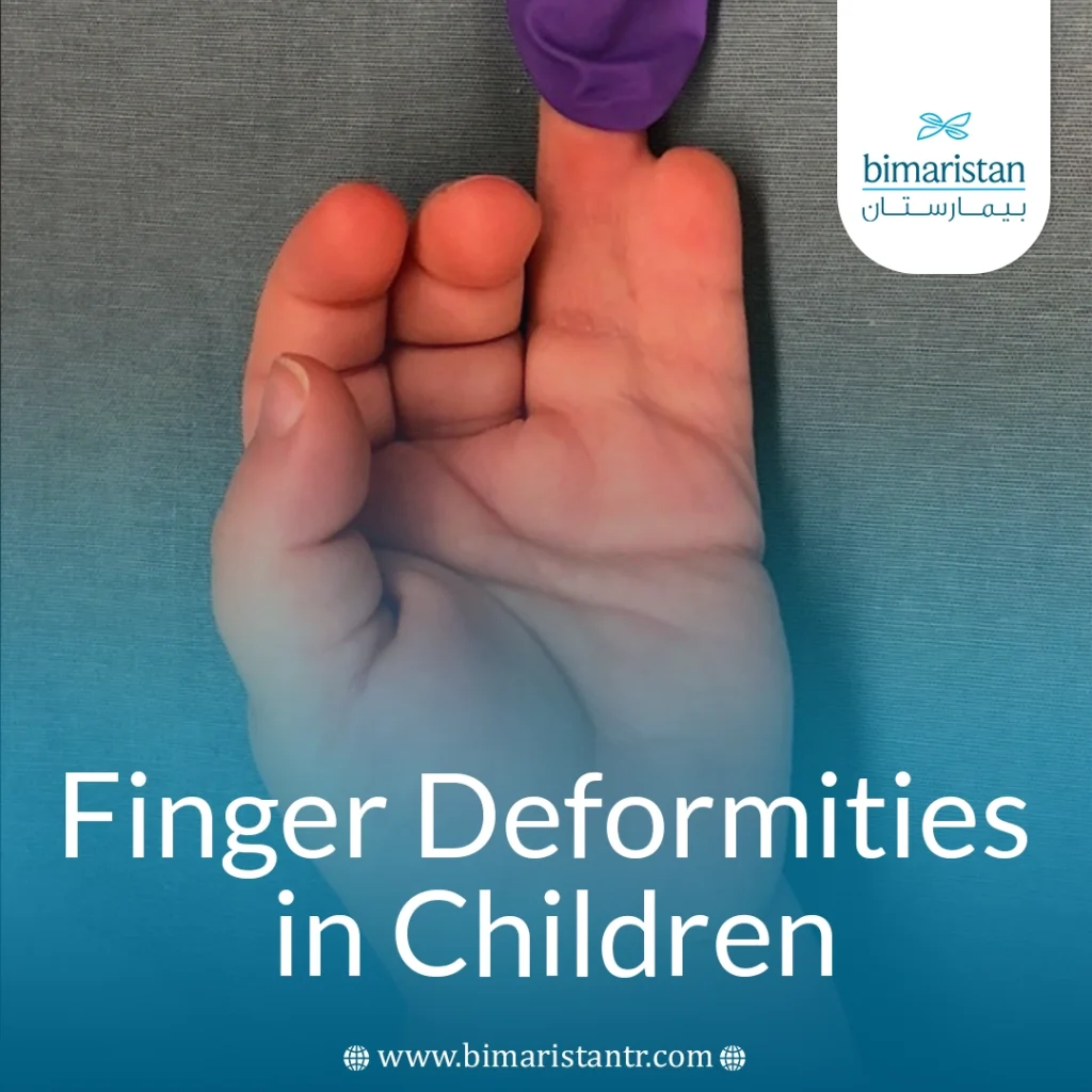 Finger Deformities In Children