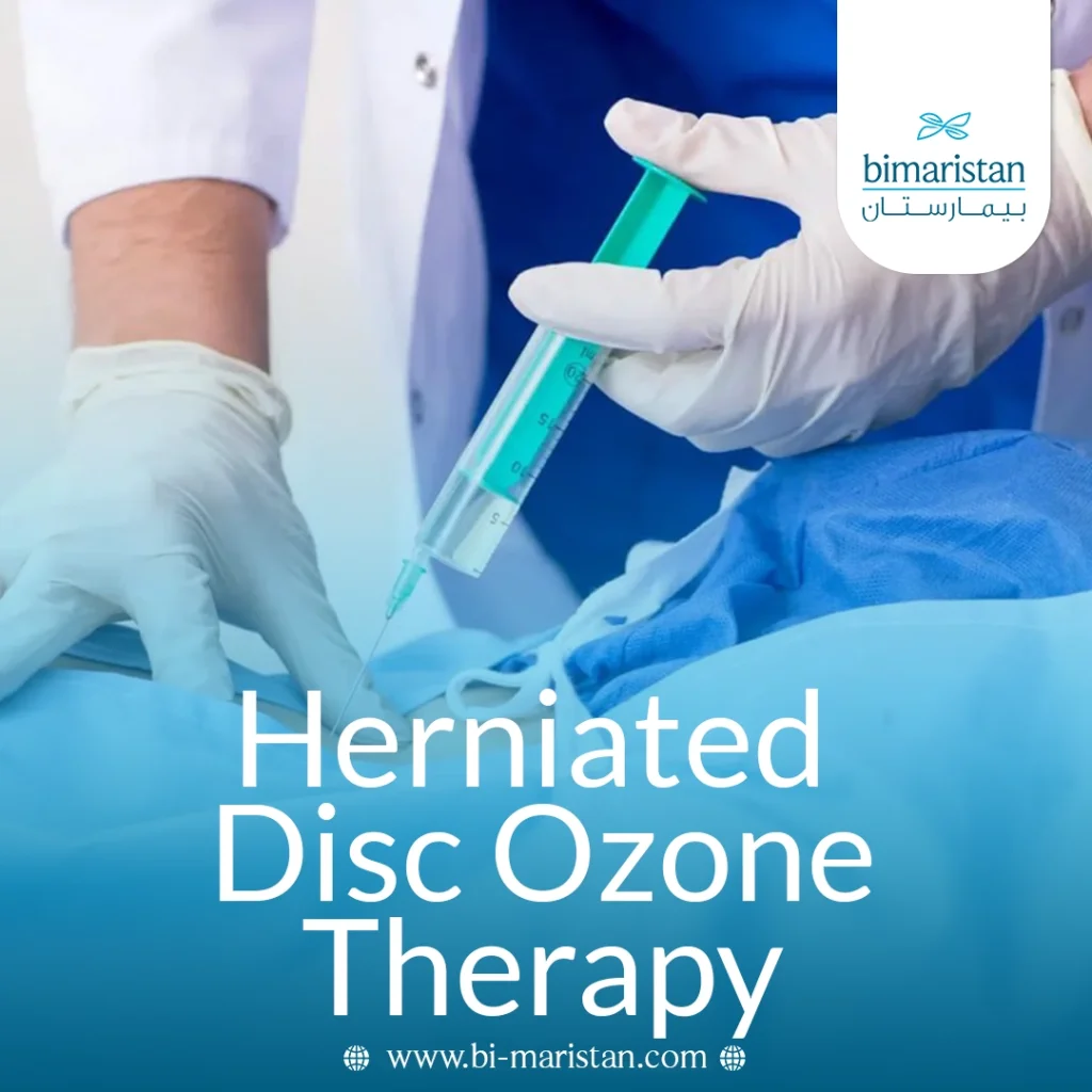 Ozone Therapy For Herniated Disc: A Modern Alternative To Surgery 6 Herniated Disc Ozone Therapy