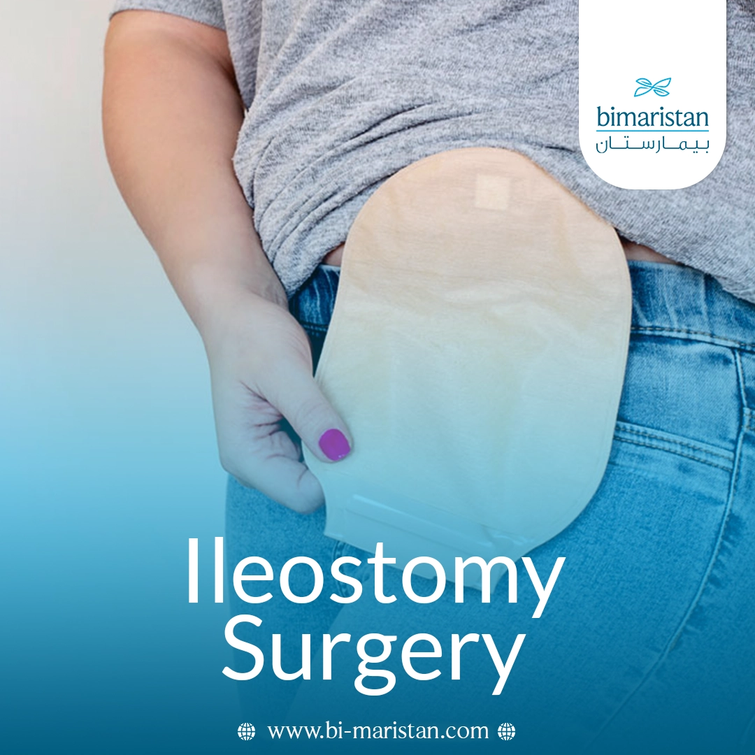 Ileostomy Surgery