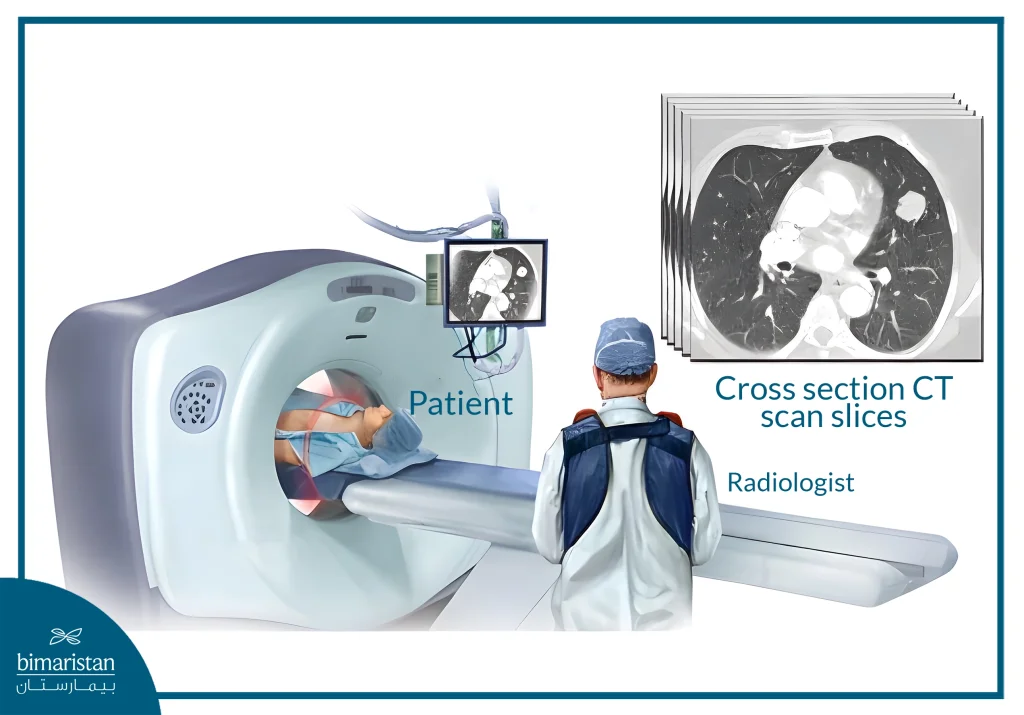 Illustration Of Low-Dose Ct Scan For Early Detection Of Lung Cancer