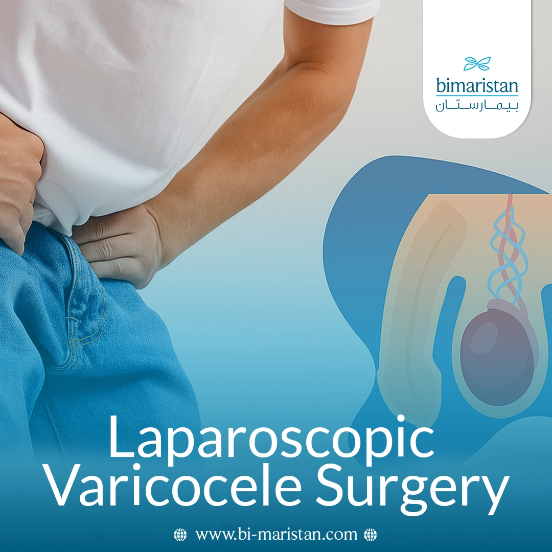 Laparoscopic Varicocele Surgery