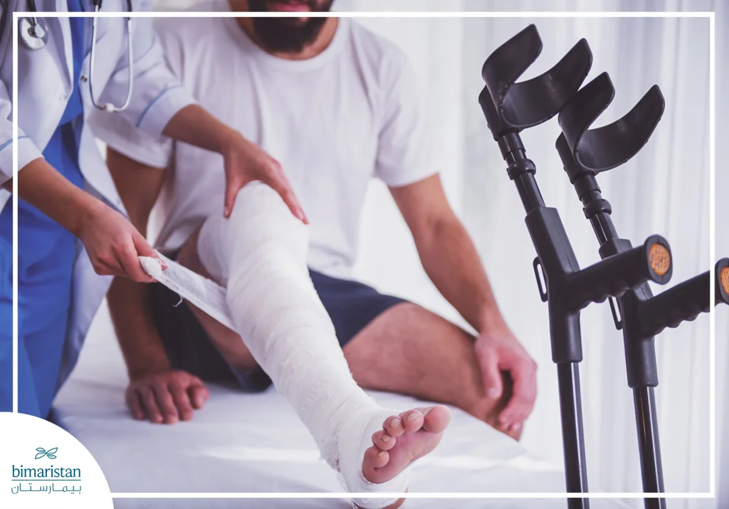 Leg Fracture: Everything You Need To Know