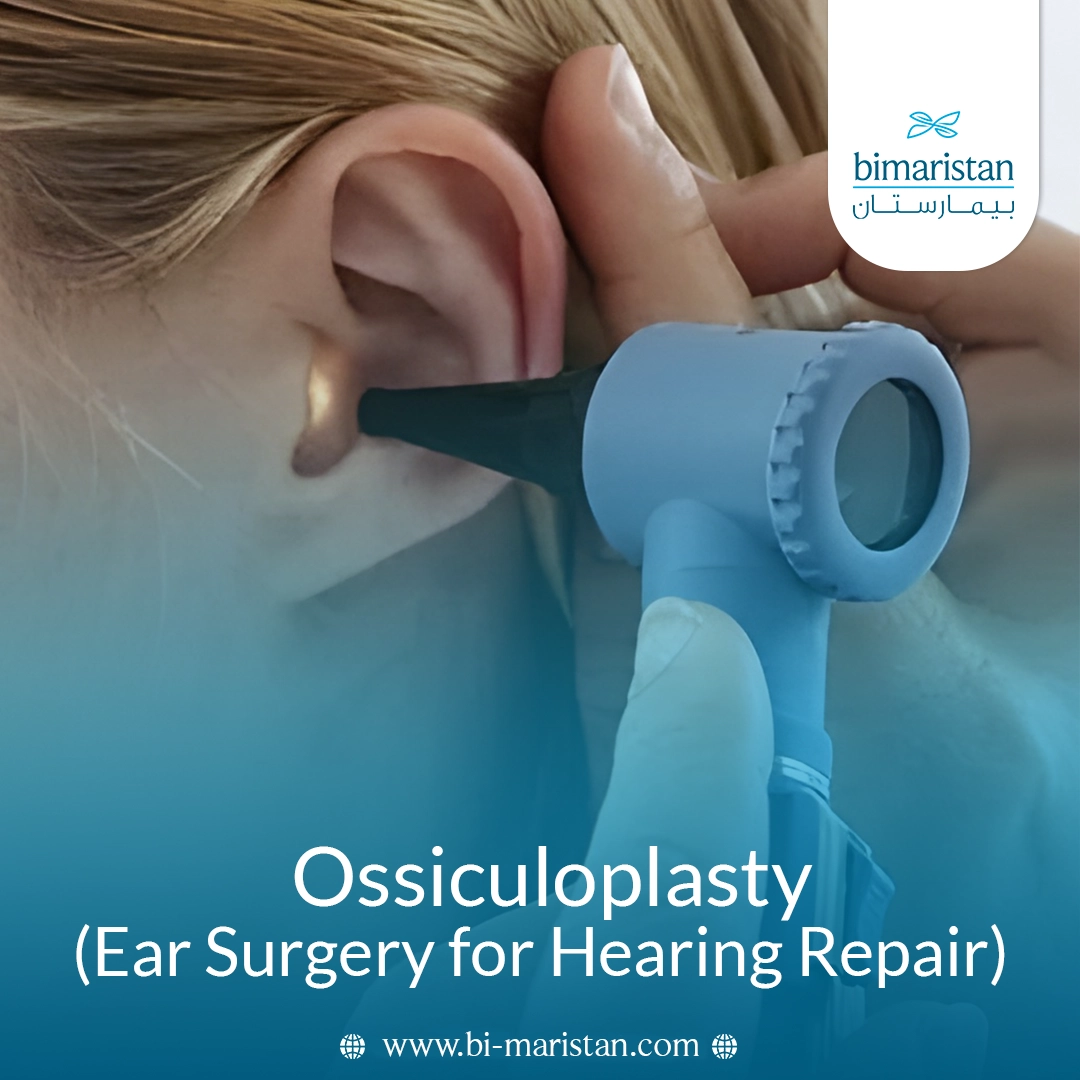 Ossiculoplasty (Ear Surgery For Hearing Repair)