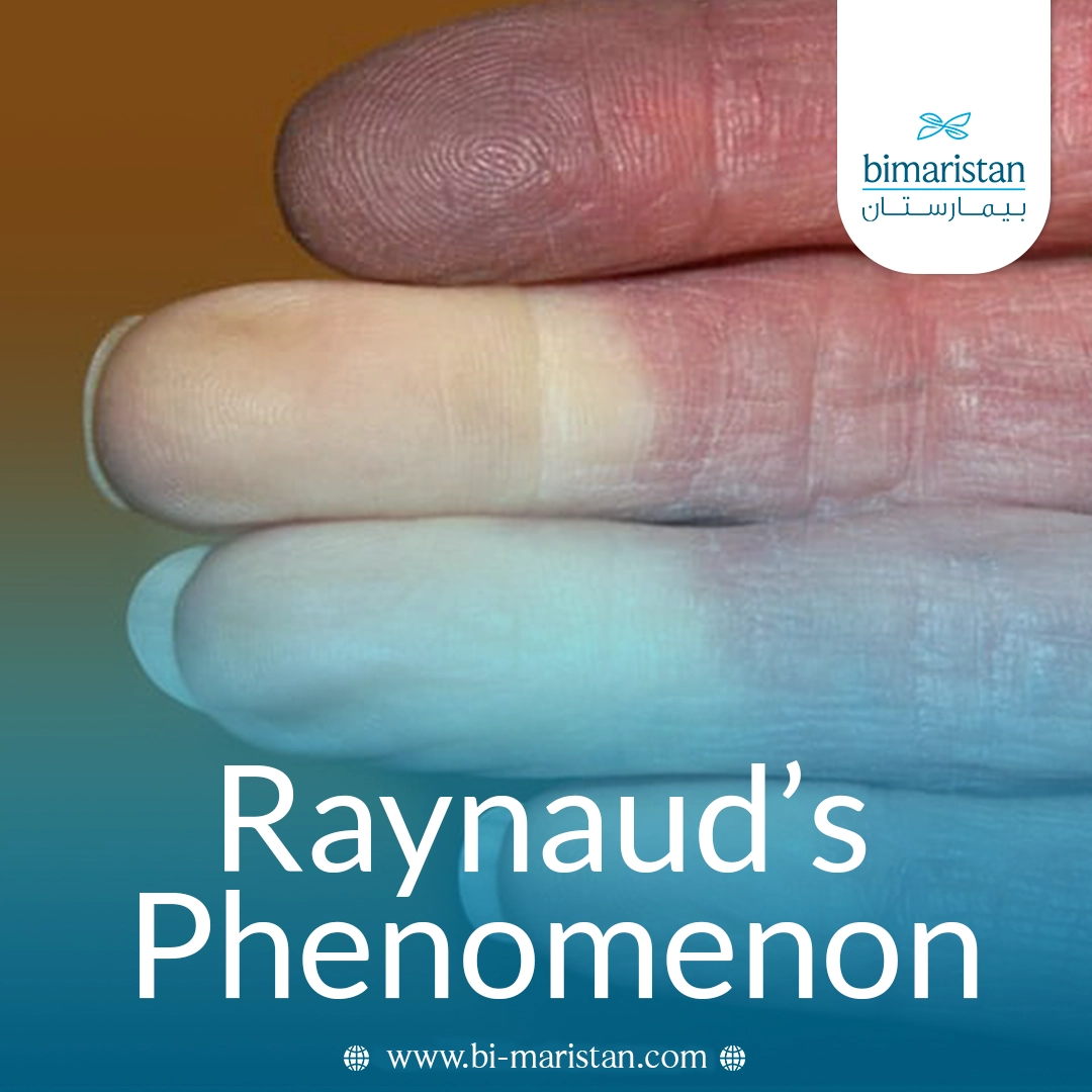 Raynaud’s Phenomenon