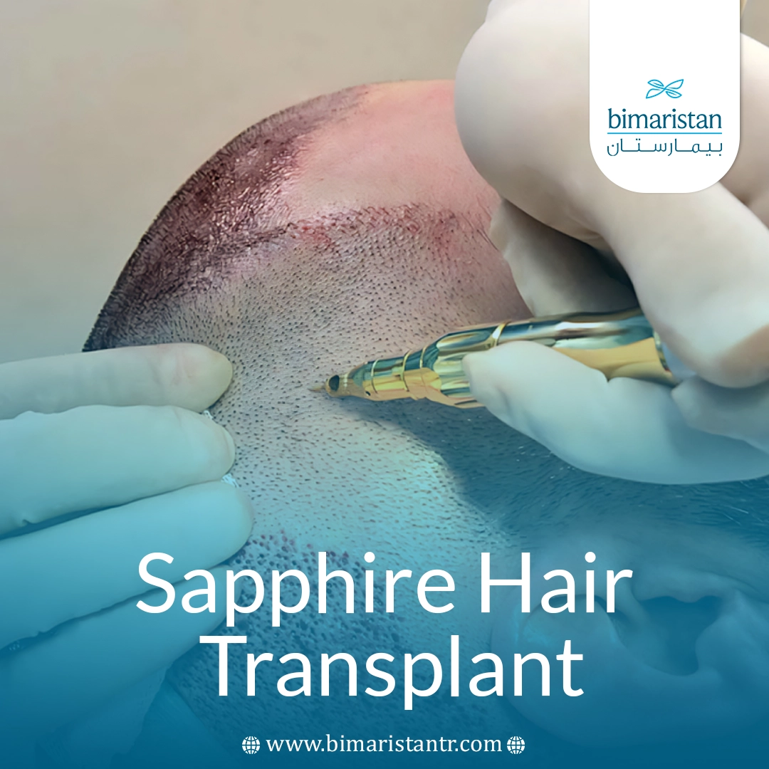 Sapphire Hair Transplant