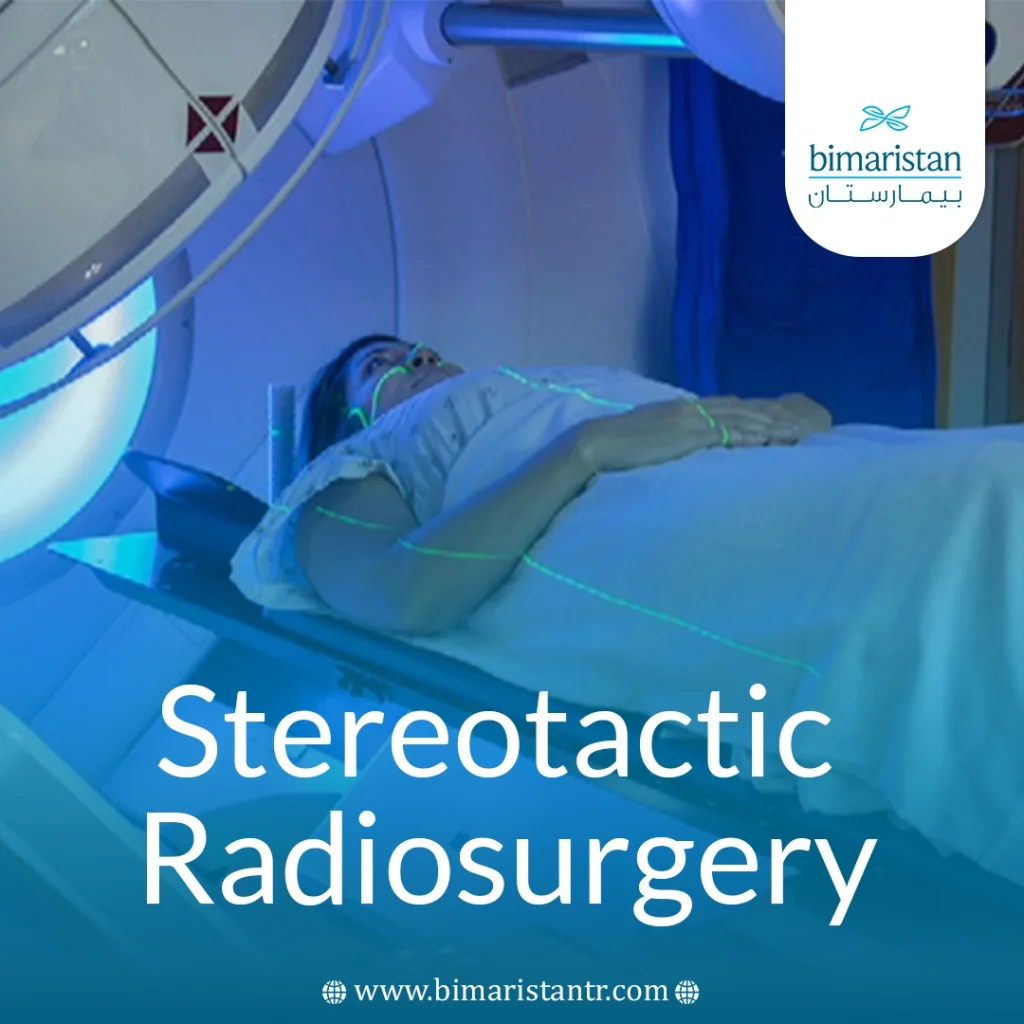Stereotactic Radiosurgery