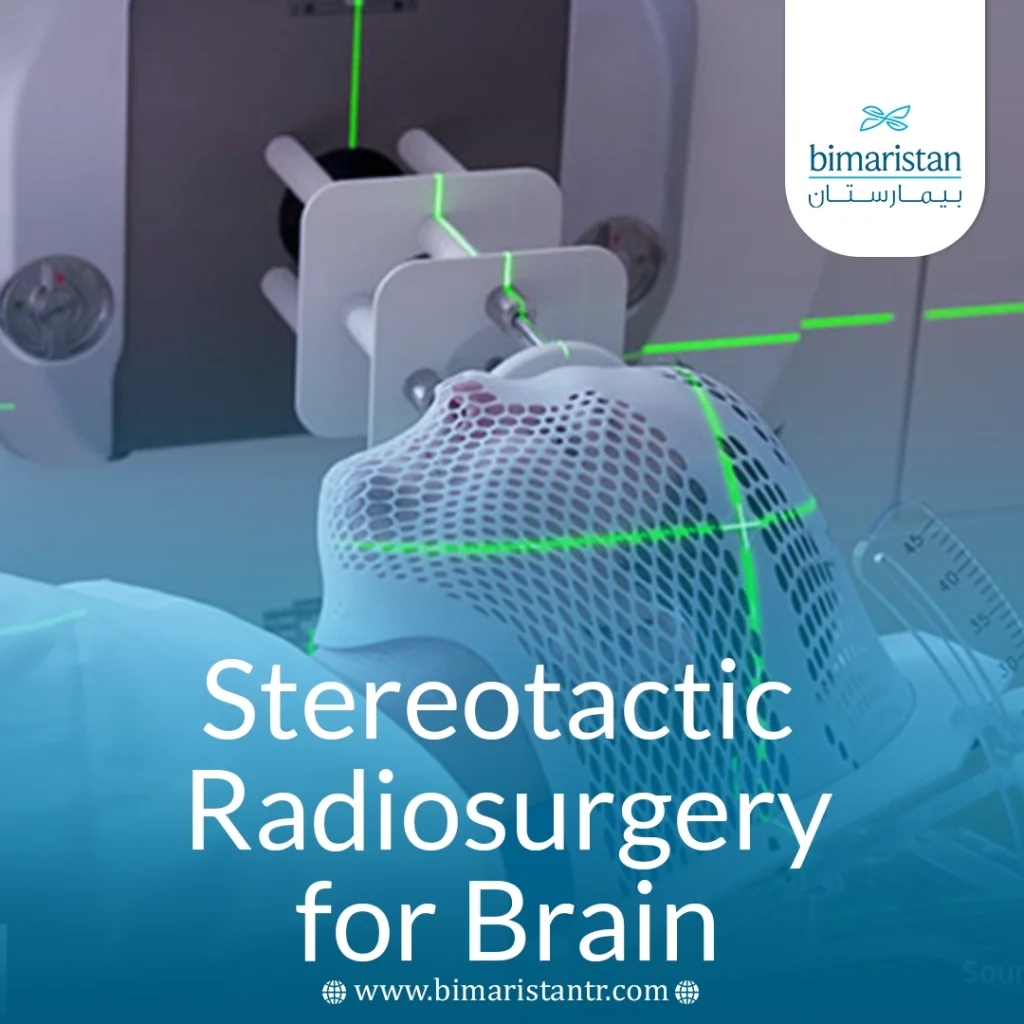 Stereotactic Radiosurgery For Brain