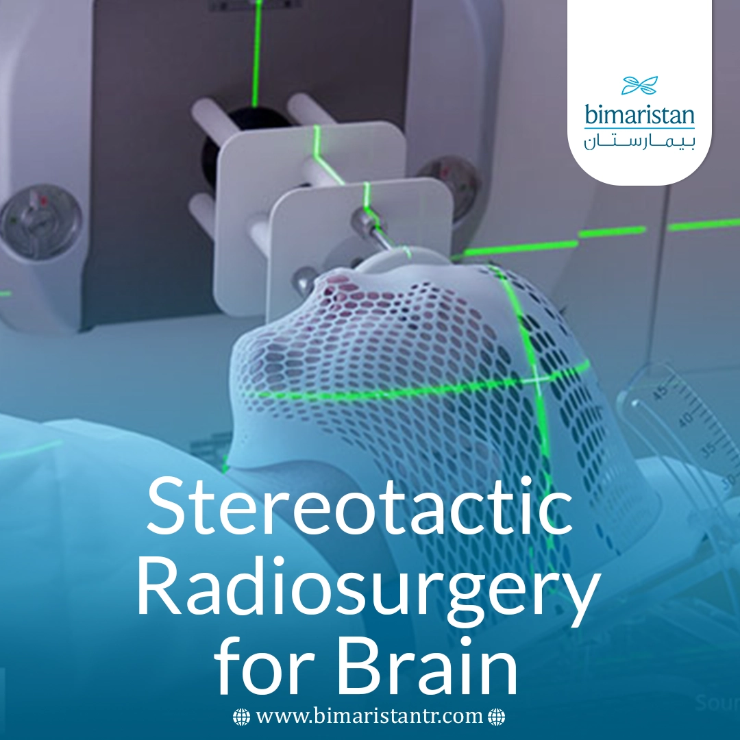 Stereotactic Radiosurgery For Brain