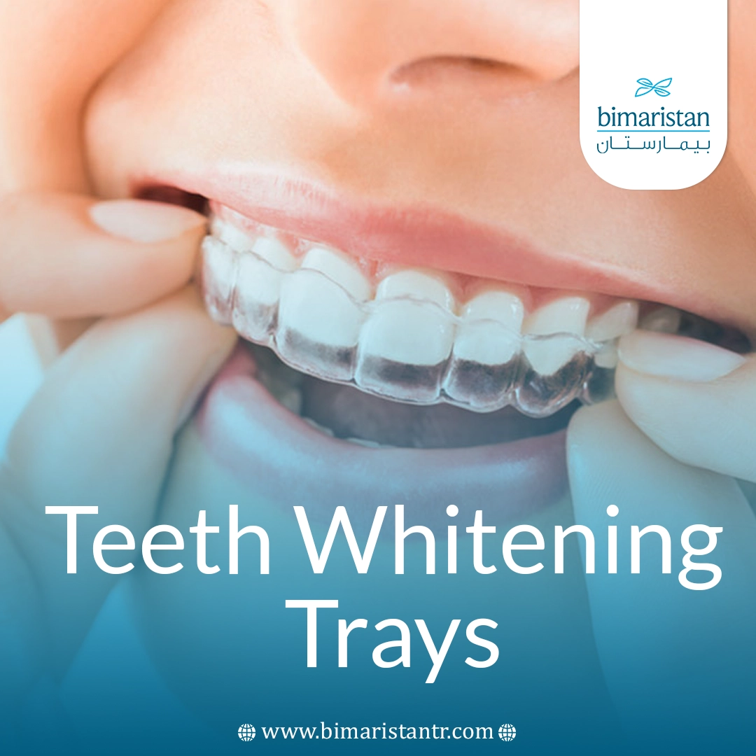 Teeth Whitening Trays: Types, How To Use, Advantages And Disadvantages 1 Teeth Whitening Trays: Types, How To Use, Advantages And Disadvantages