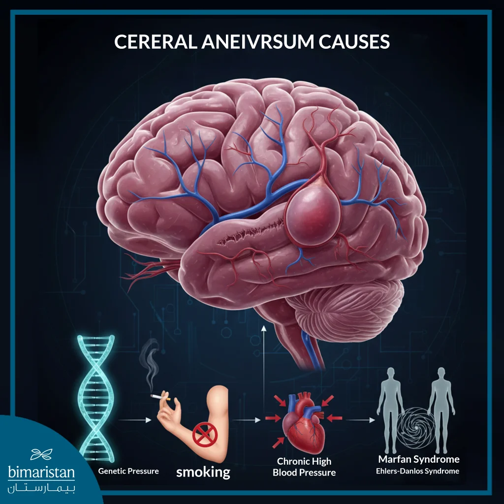 The Image Illustrates The Causes Of Cerebral Aneurysm.
