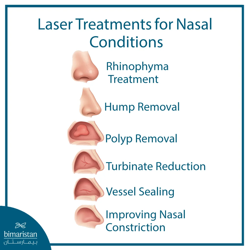 The Image Illustrates The Indications For Laser Treatment Of The Nose.