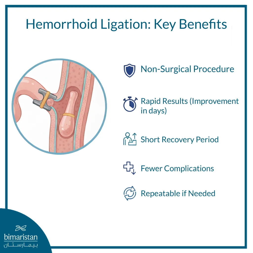 Hemorrhoid Banding: A Simple, Non‑Surgical Solution 4 The Image Illustrates The Key Features Of Hemorrhoid Banding