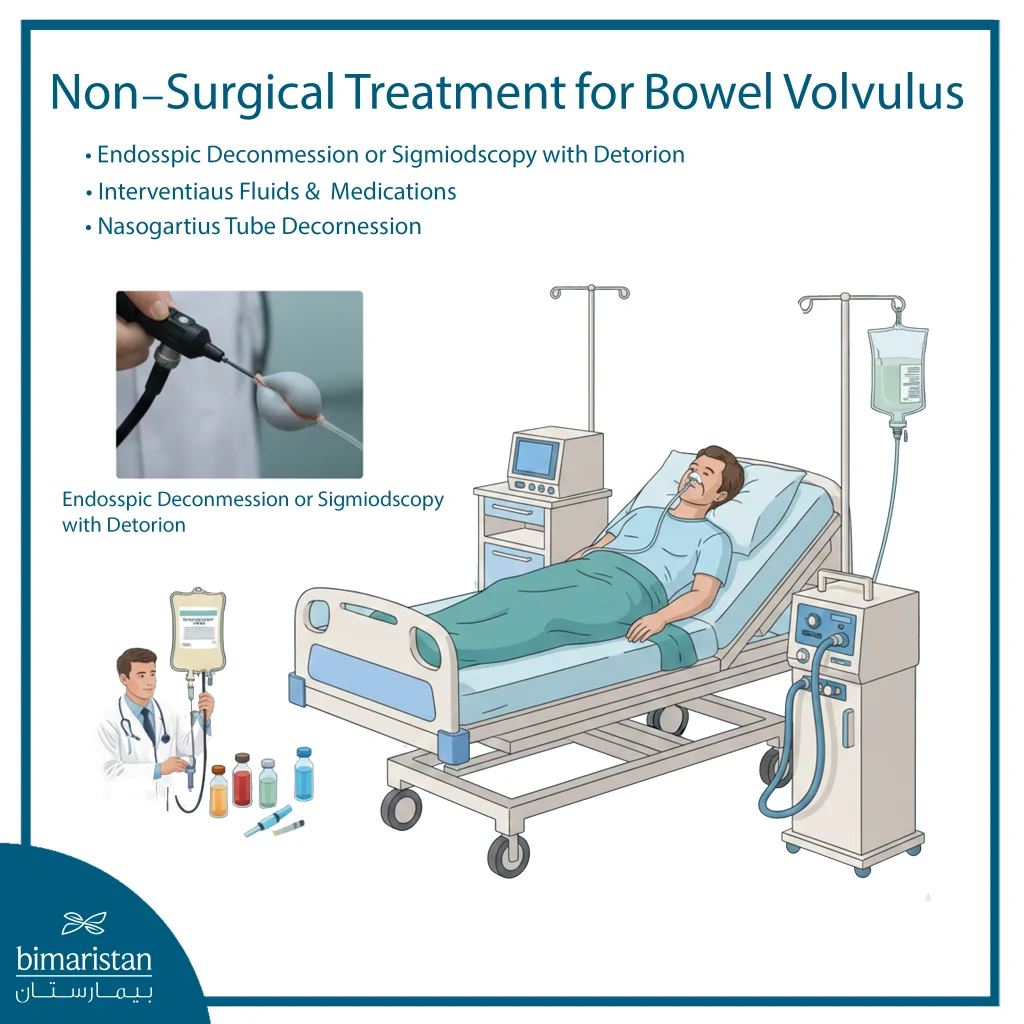The Image Illustrates The Non-Surgical Treatment Of Bowel Volvulus