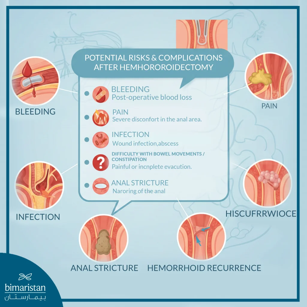 The Image Illustrates The Potential Risks And Complications After Anal Hemorrhoidectomy.