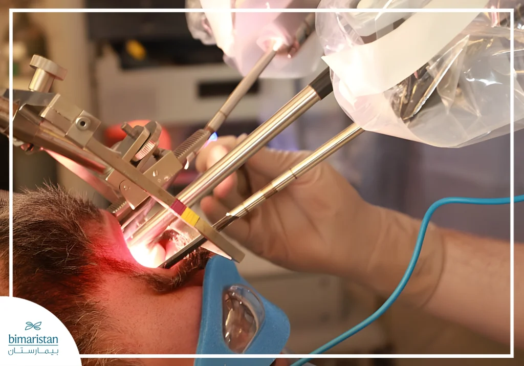The Image Shows Pharyngeal Surgery Performed Using Robotic Technology.