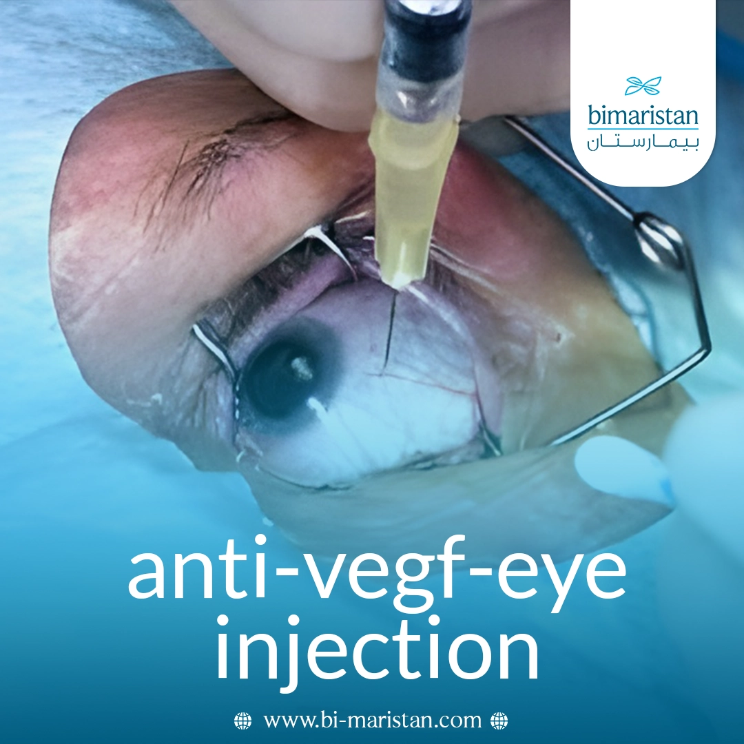 Intraocular Injections To Treat Retinal Diseases: Efficacy And Treatment Method