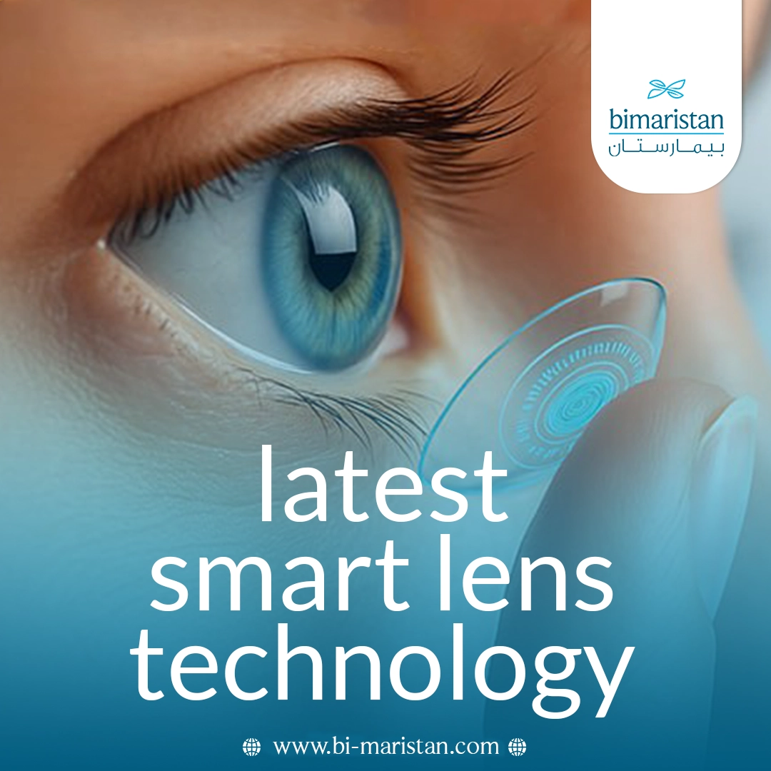 Smart Lenses