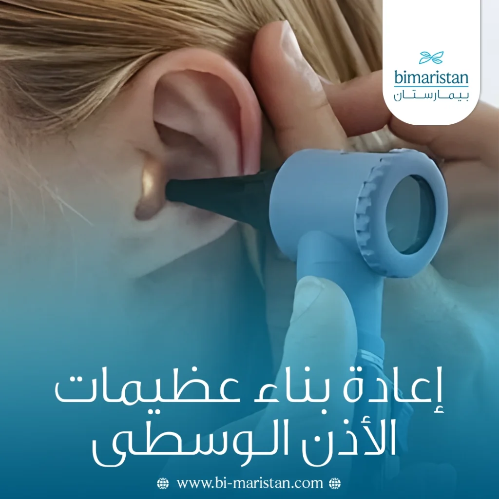 إعادة بناء عظيمات الأذن الوسطى