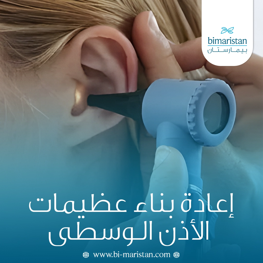 إعادة بناء عظيمات الأذن الوسطى