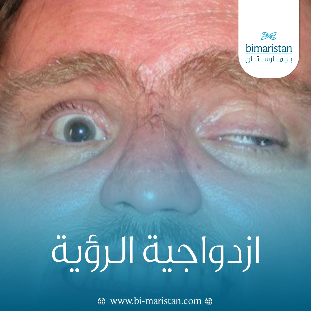 ازدواجية الرؤية