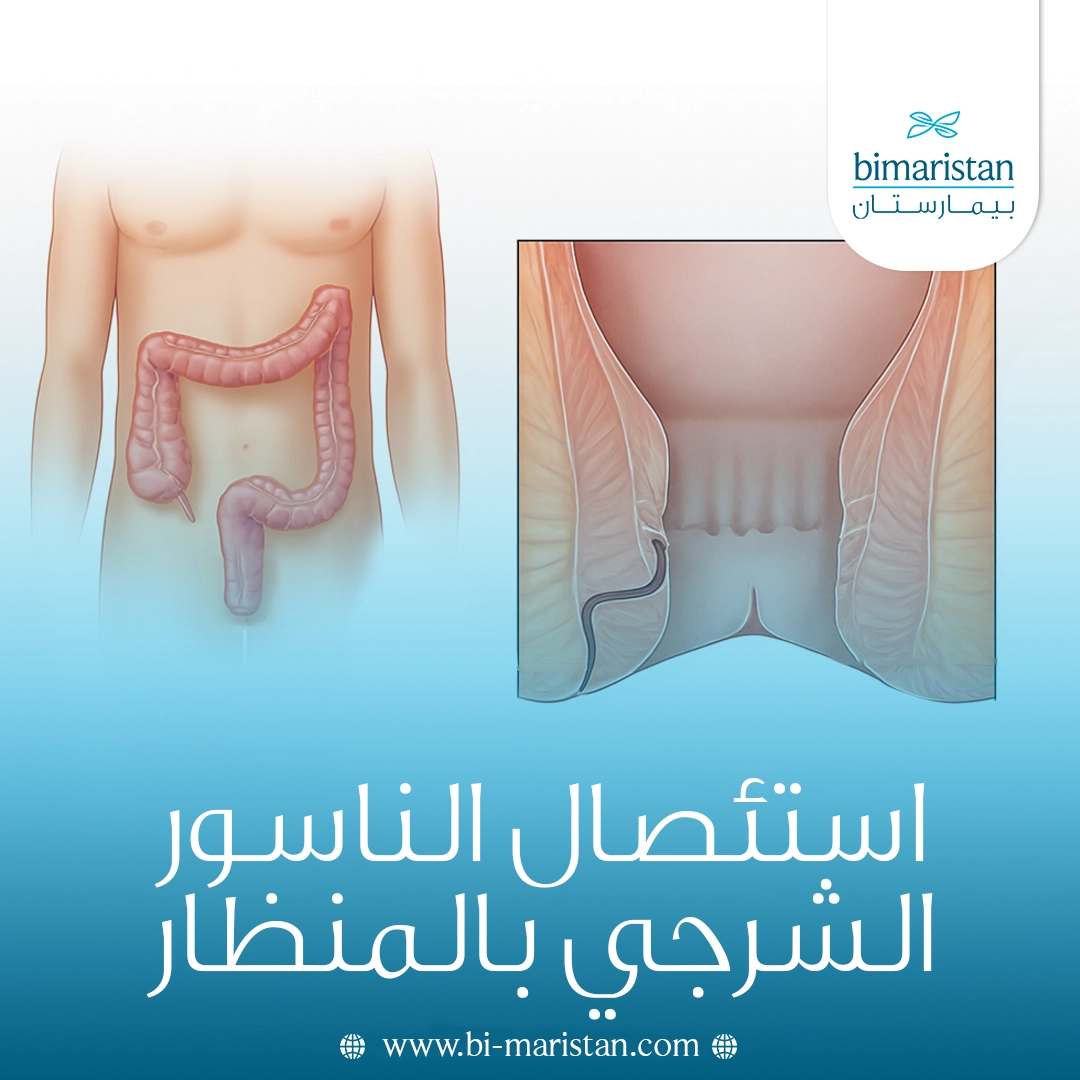 استئصال الناسور الشرجي بالمنظار