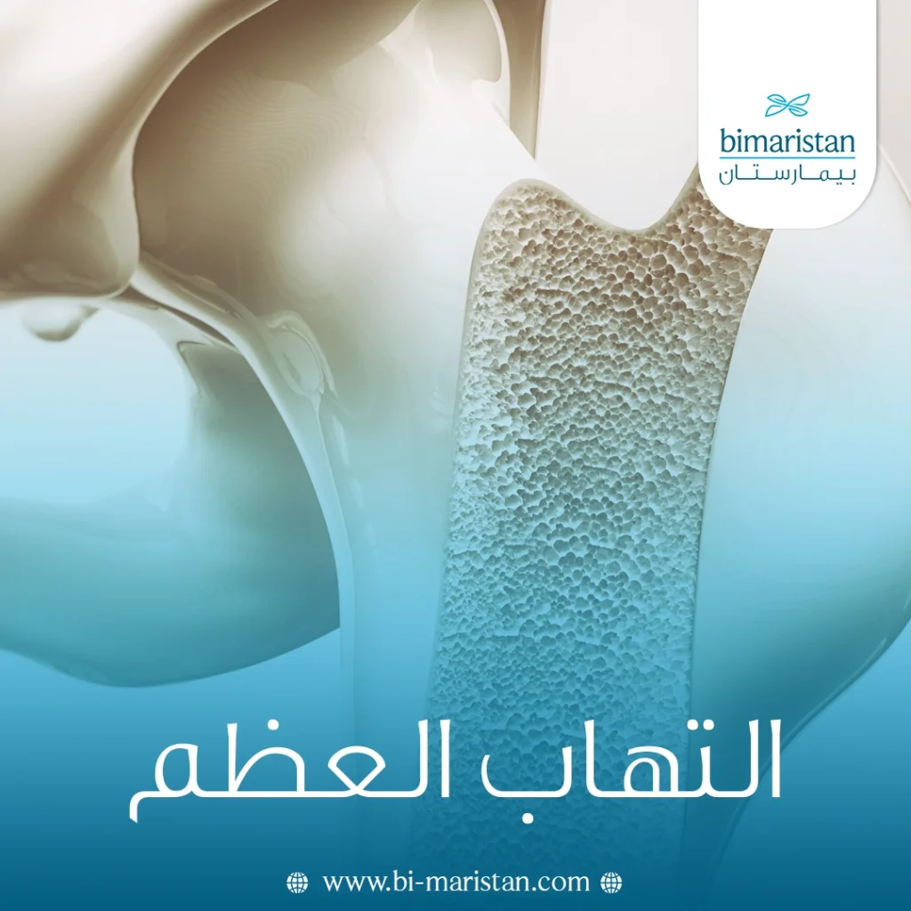 التهاب العظم