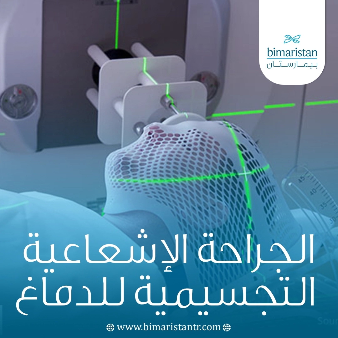 الجراحة الإشعاعية التجسيمية للدماغ