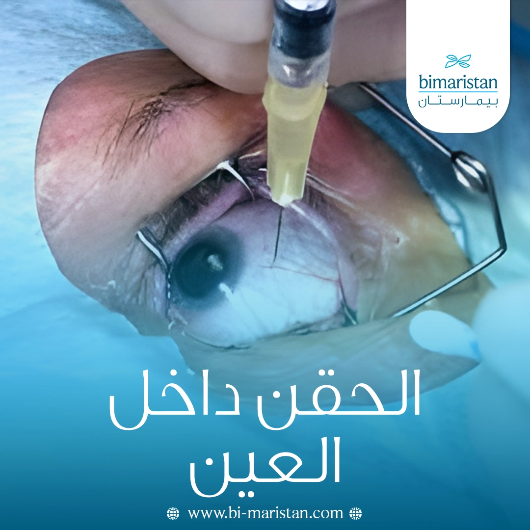 الحقن داخل العين