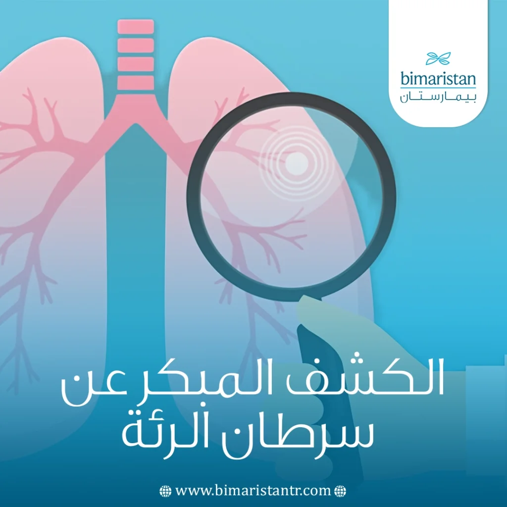 الكشف المبكر عن سرطان الرئة