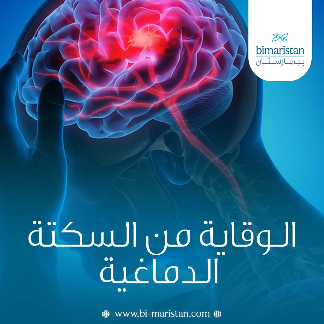 الوقاية من السكتة الدماغية