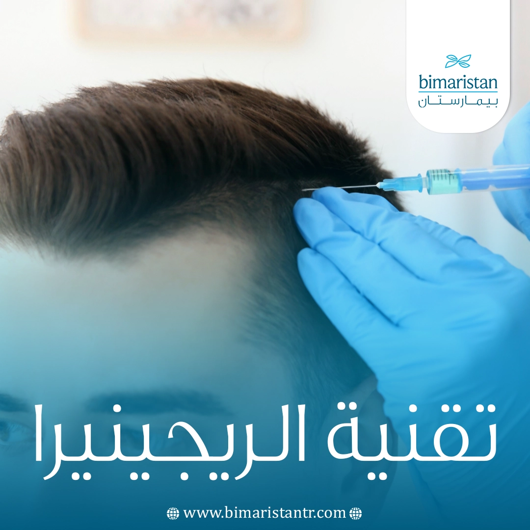 تقنية الريجينيرا