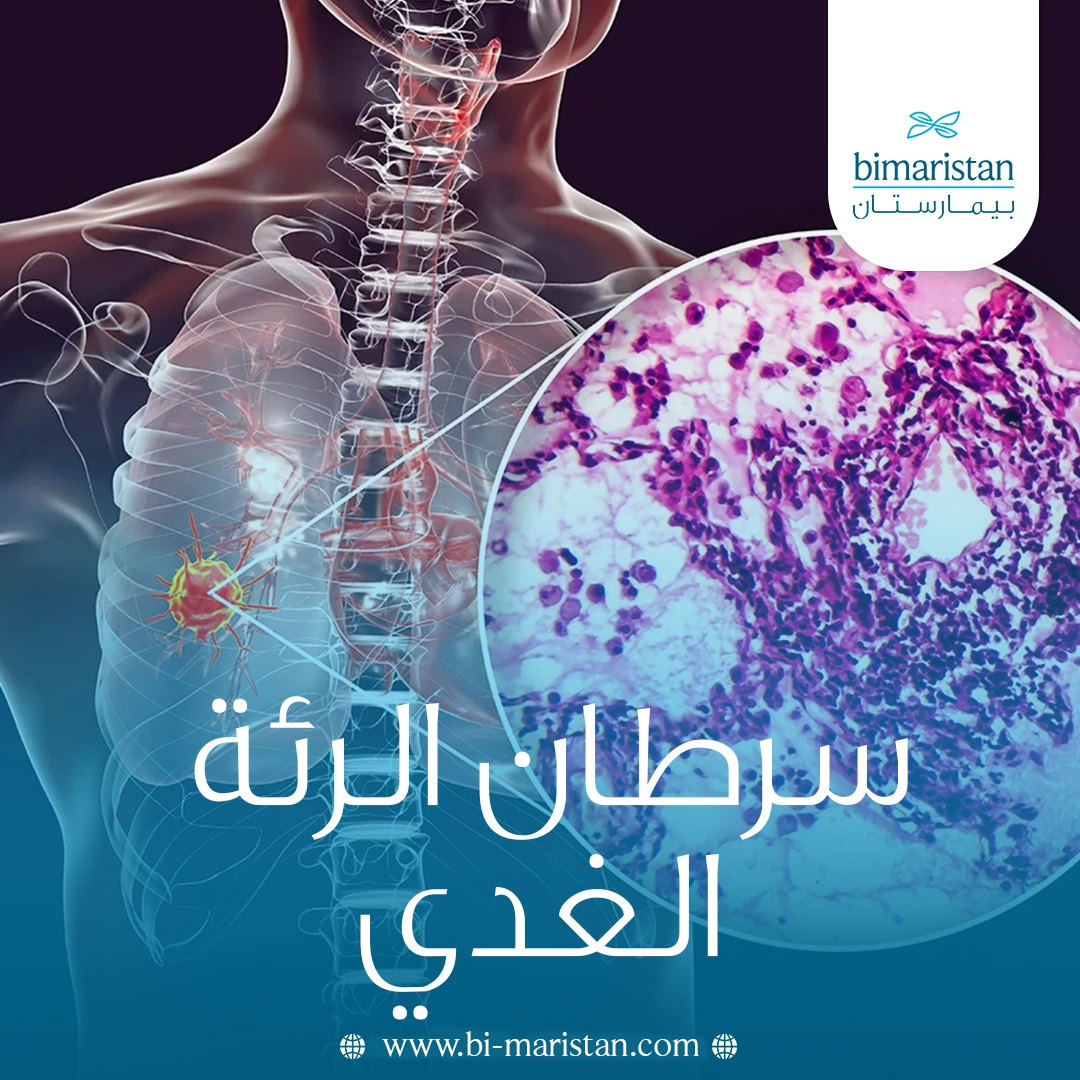 سرطان الرئة الغدي