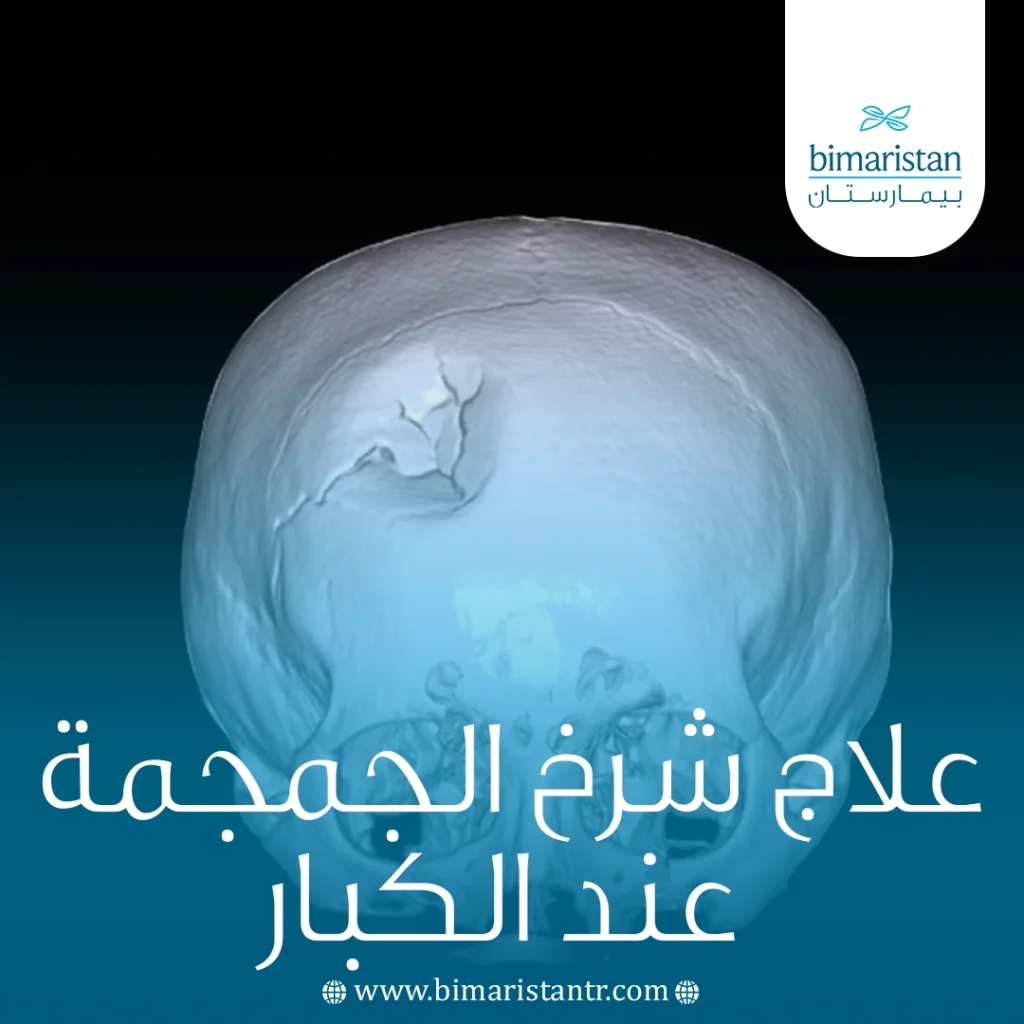 علاج شرخ الجمجمة عند الكبار