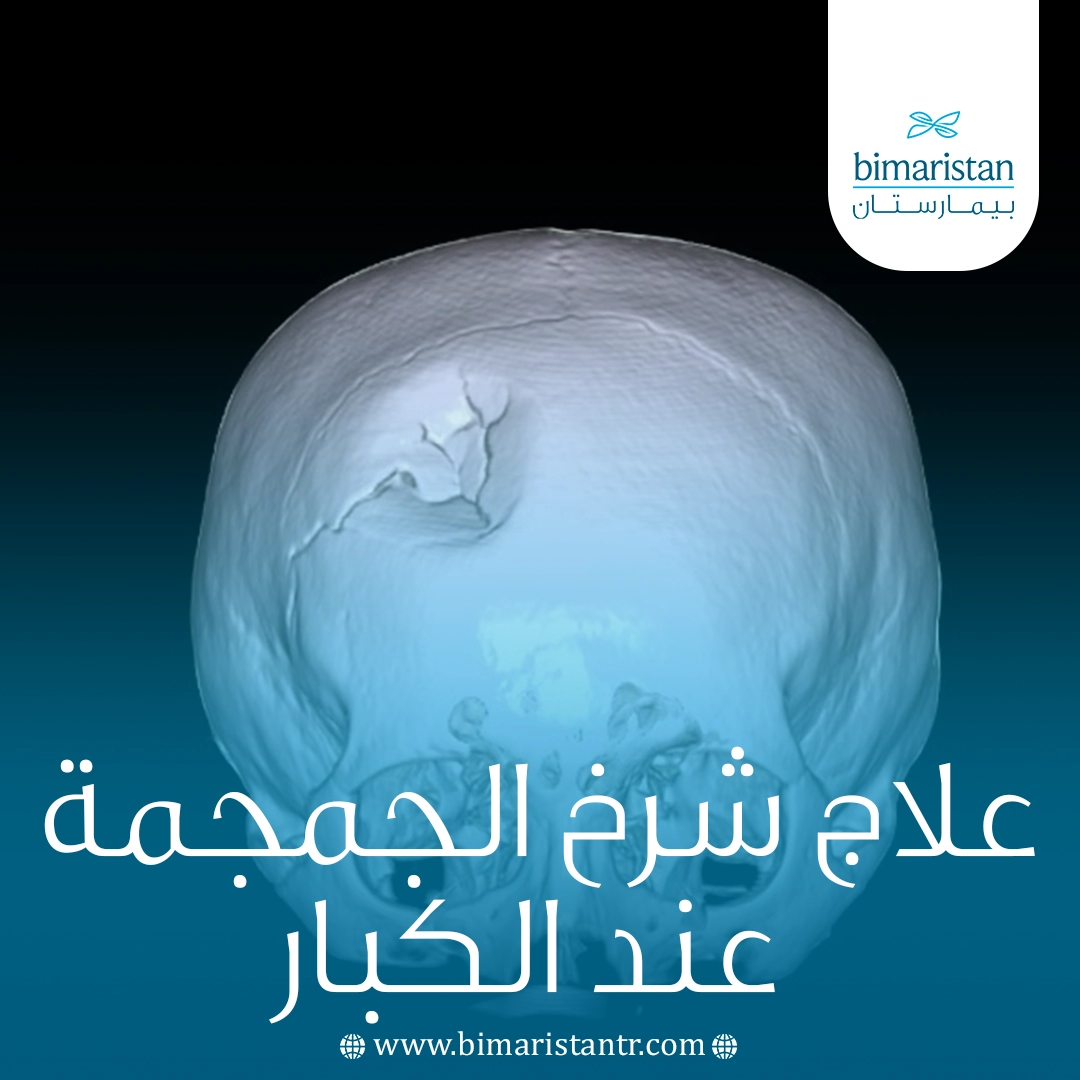 علاج شرخ الجمجمة عند الكبار
