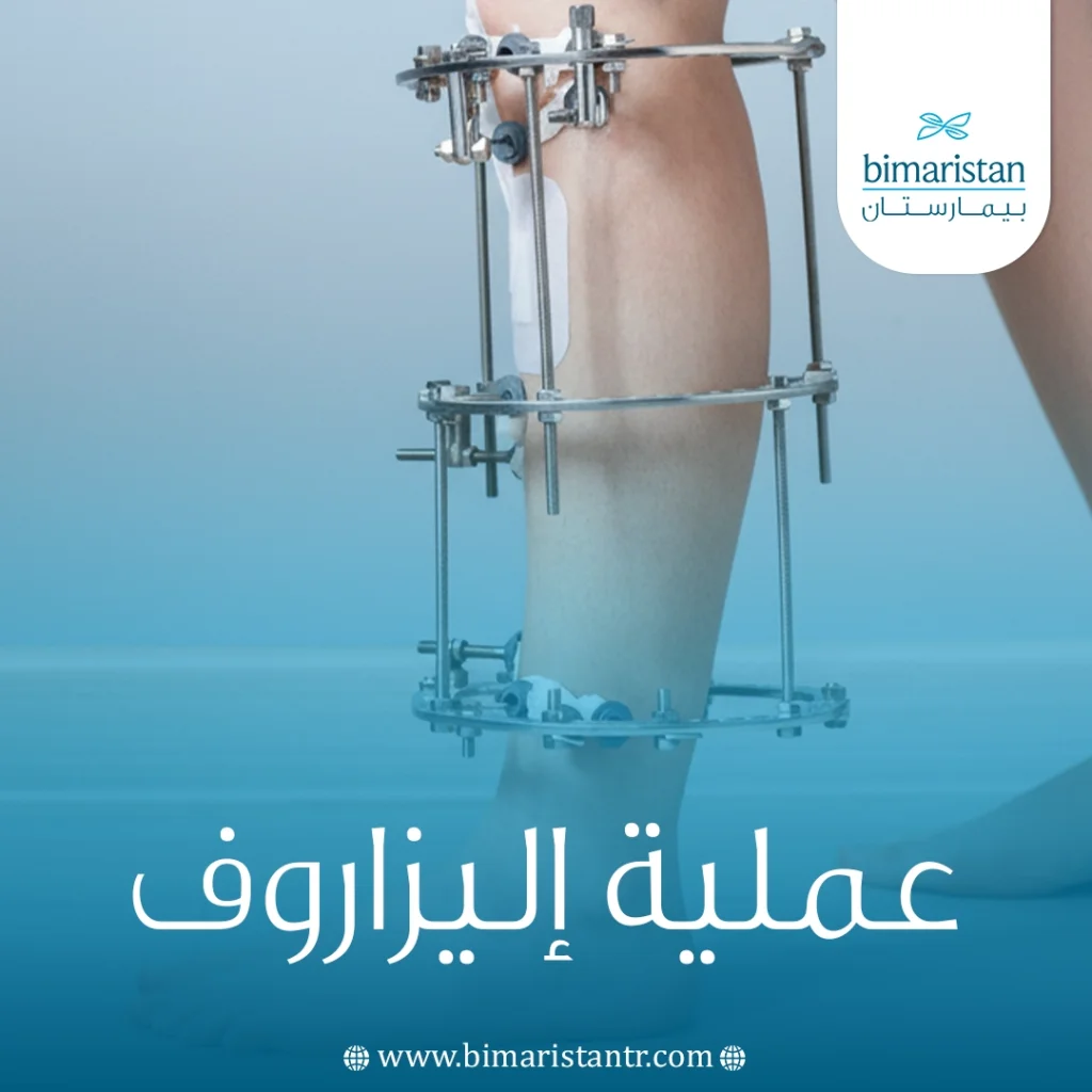 عملية إليزاروف