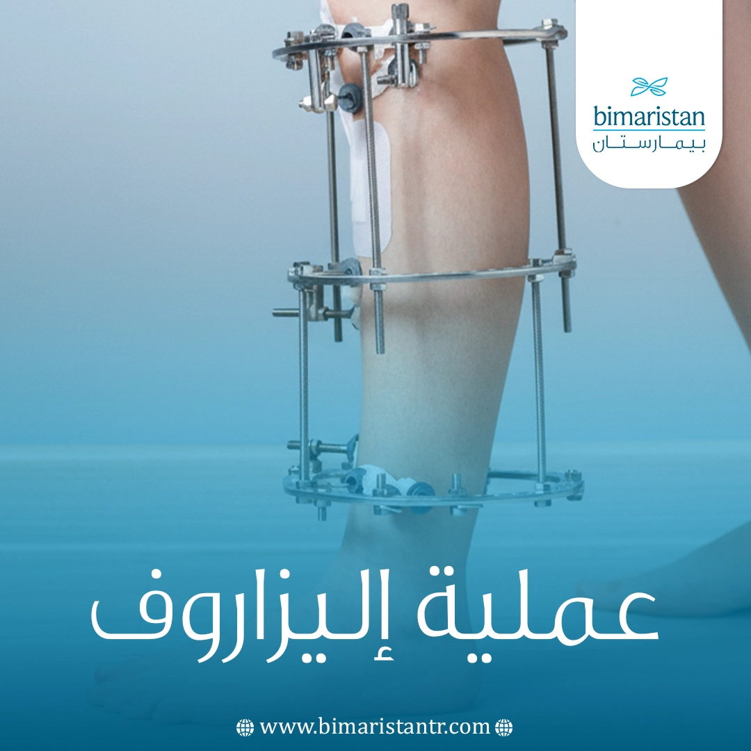 عملية إليزاروف