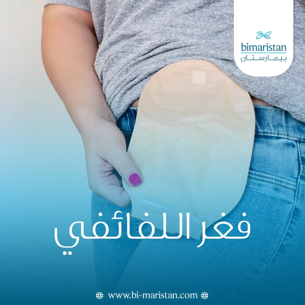 فغر اللفائفي