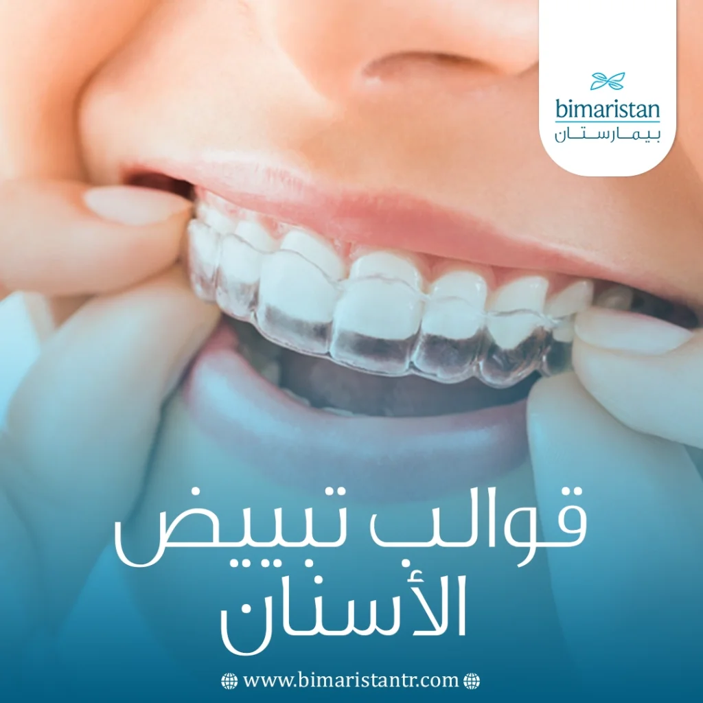 قوالب تبييض الأسنان: الأنواع، طريقة الاستخدام، المزايا والعيوب 3 قوالب تبييض الأسنان