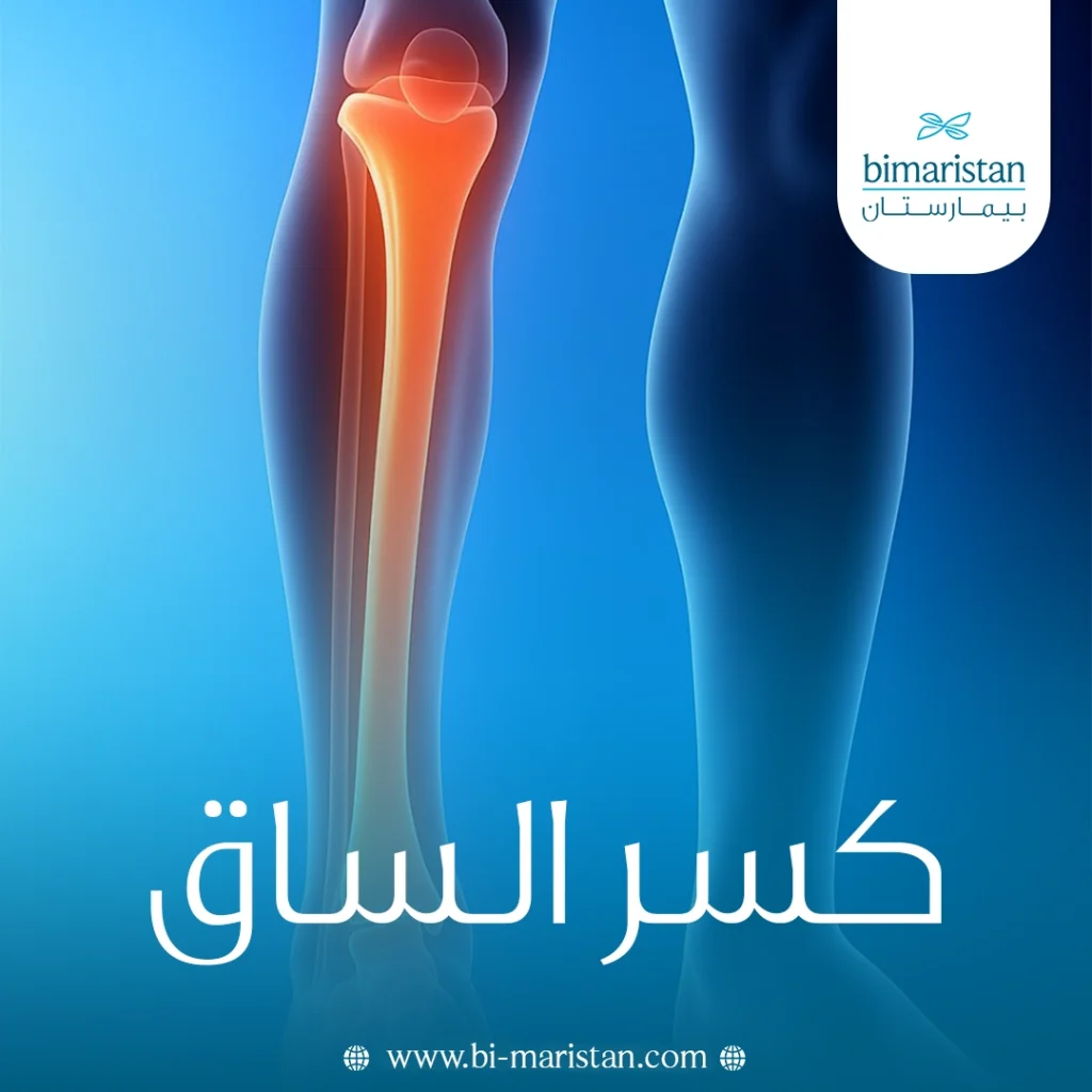 كسر الساق كيفية تحديد نوعه وطرق علاجه 15 كسر الساق