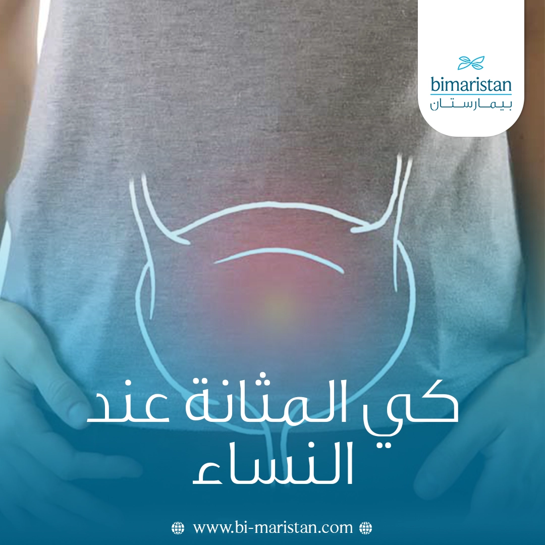 كي المثانة عند النساء