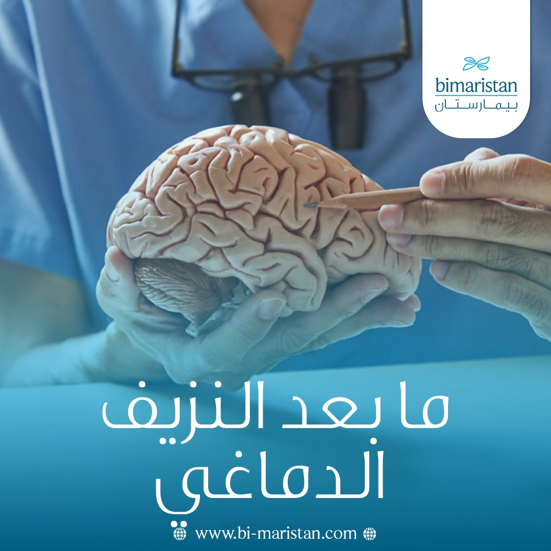 ما بعد النزيف الدماغي