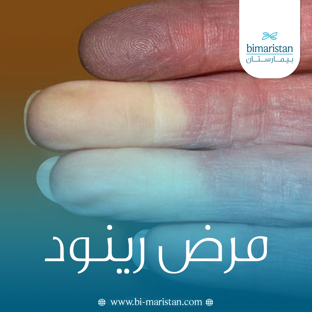مرض رينود