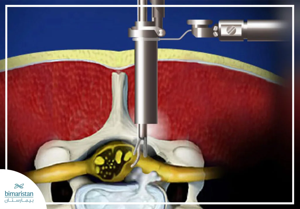 A Picture Illustrating The Procedure Using A Microscope